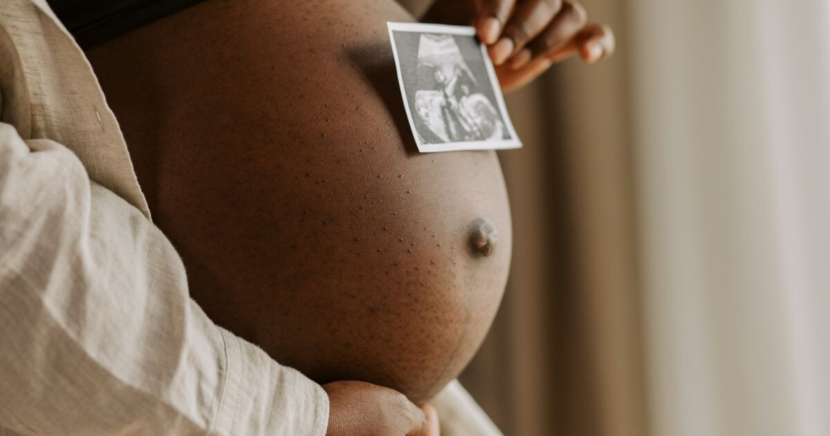 Image pour l'article Naturopathie et grossesse : la méthode secrète des futures mamans les plus zen